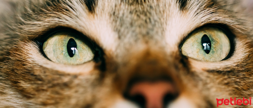 Frequently Asked Questions About Cataract Disease
