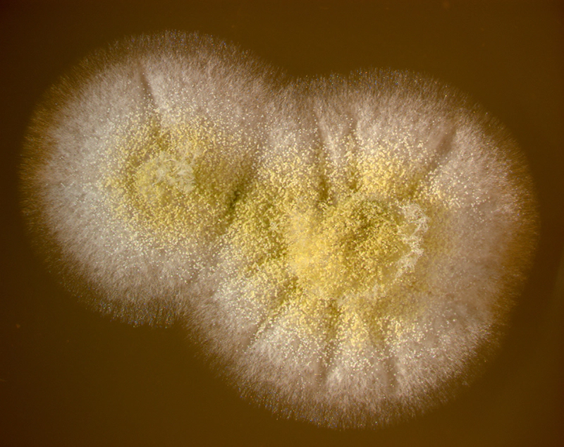 Microscopic image of aspergillosis fungus